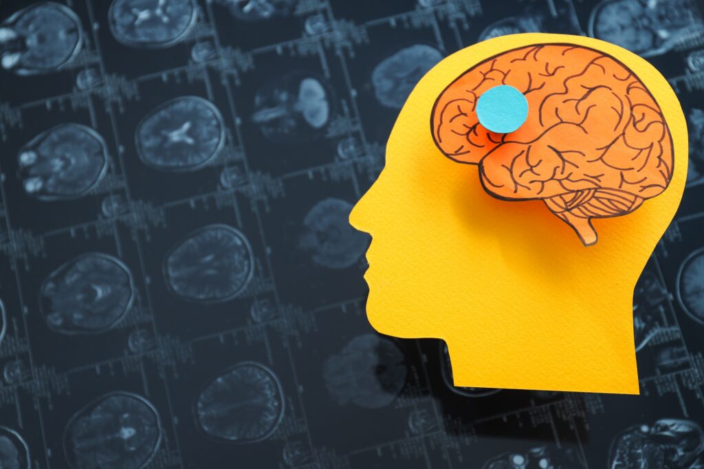 MRI images or magnetic resonance imaging with paper human head and brain.