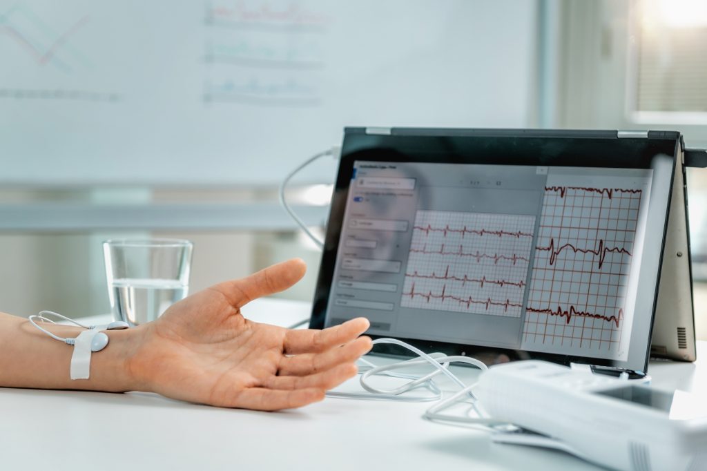 Biofeedback - Female hand with attached sensors for heart rate measurement.