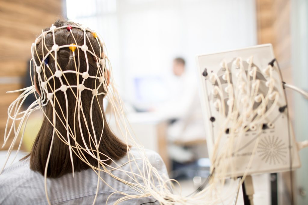 Brain activity medical test